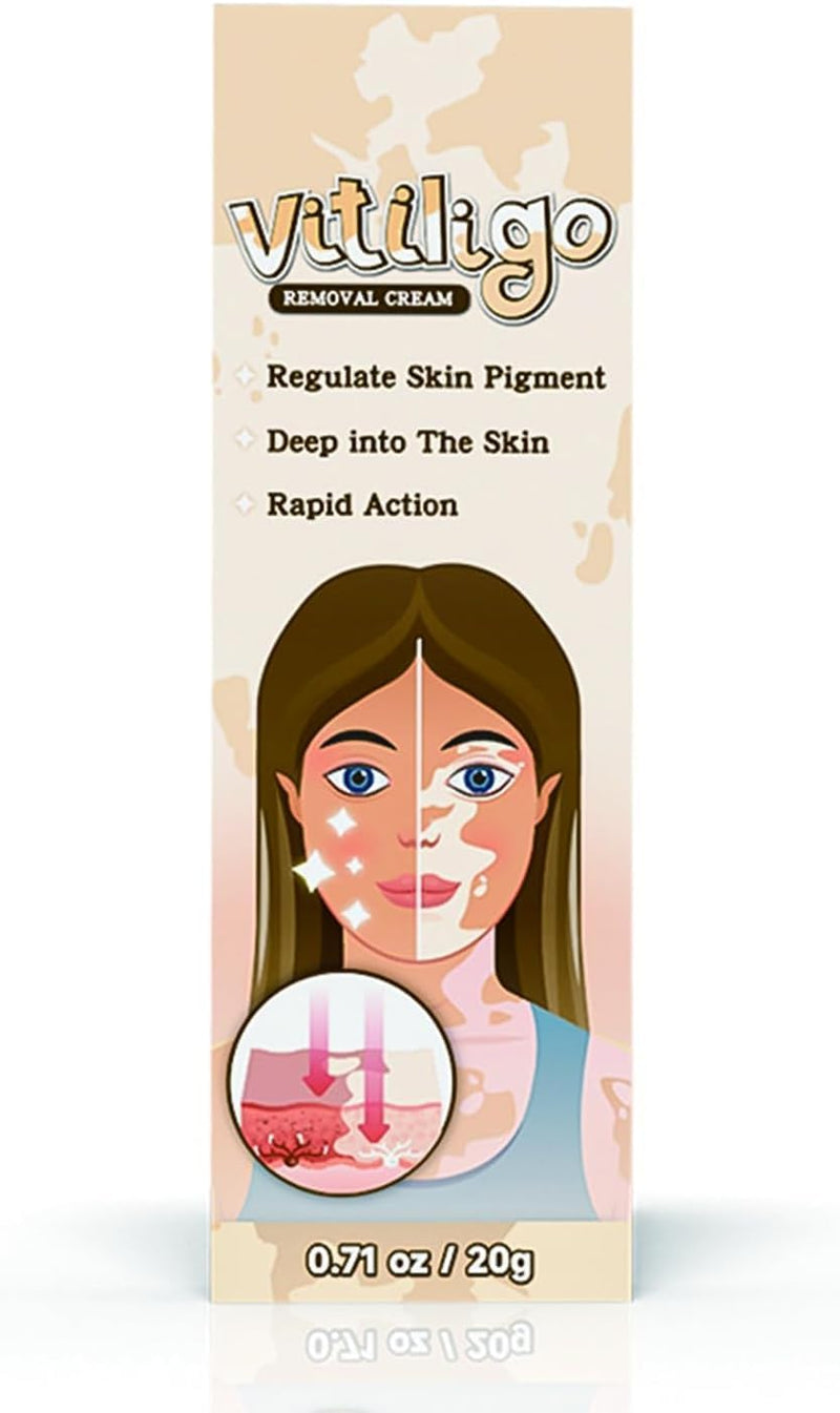 Natural Vitiligo Cream