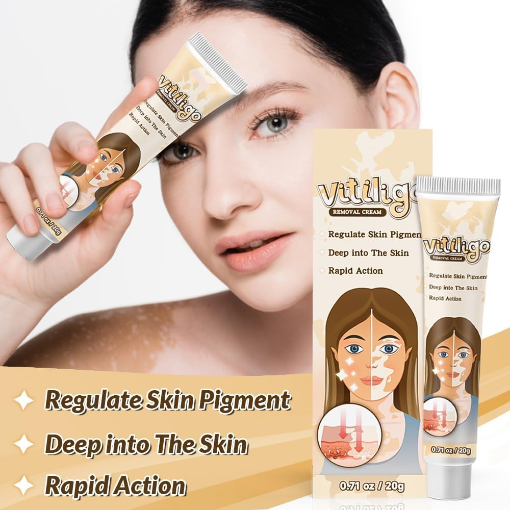 Natural Vitiligo Cream
